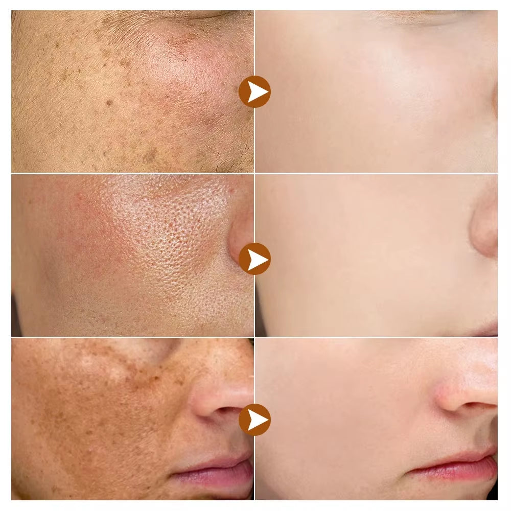 Glowfade™ Spotless Radiance Skin Brightening Serum